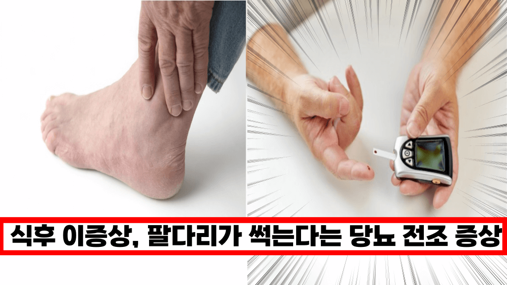 ‘ 이증상 나타나고 당뇨 생겼습니다.’ 혈당이 비정상적으로 급격하게 상승하는 전조 증상