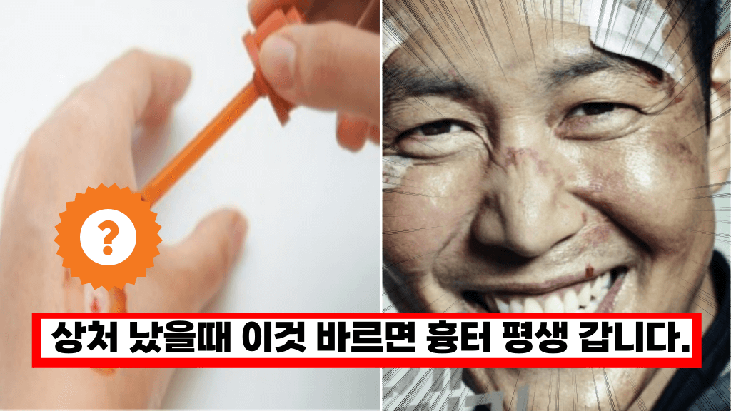 이거 바르면 흉터가 평생 남습니다. 전국민 99% 모르는 상처나면 제일 먼저 바르는 약