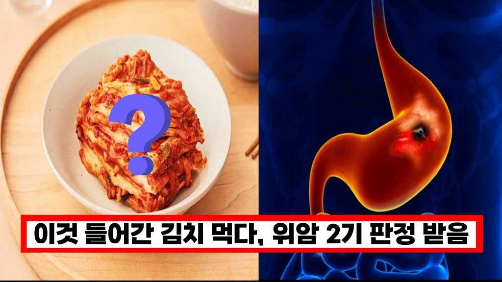 ‘김치에 절대 이것 넣지 마세요’ 김치에 이것 들어가면 발암 물질, 독성물질이 섞여버립니다.