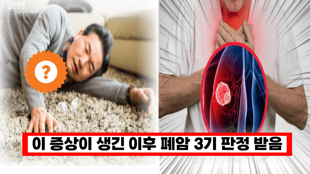 ‘조기 발견하지 못하면 생존률 10% 이하’ 이곳에 땀이 많이 난다면 폐암 발병을 의심하셔야 합니다.