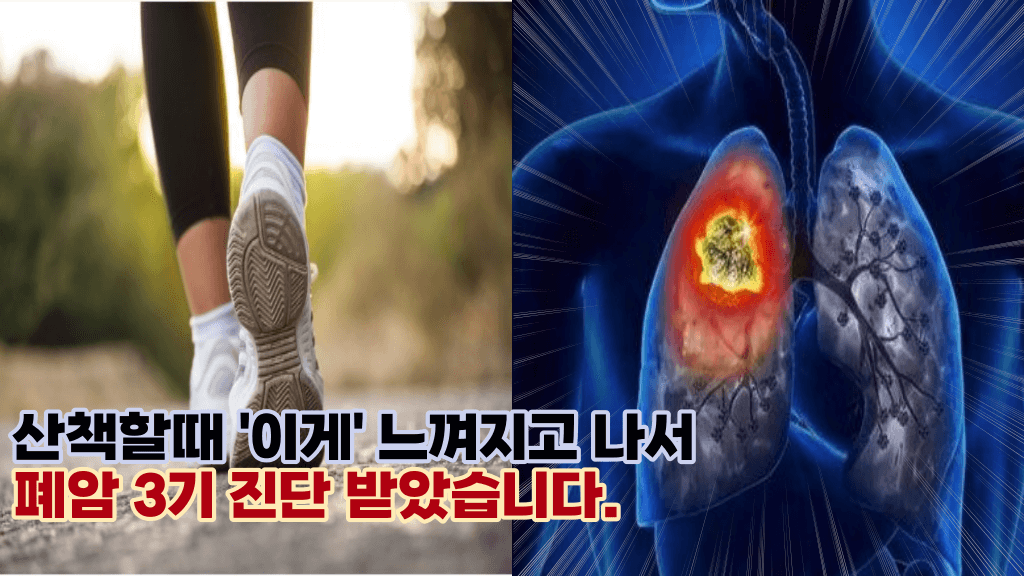 걸을 때 나타나는 이 증상으로 알수 있는 폐암의 초기 증상