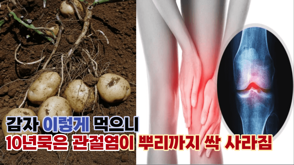 천연 관절 치료제 감자 ‘이렇게’ 드시면 관절염을 뿌리까지 뽑아버림