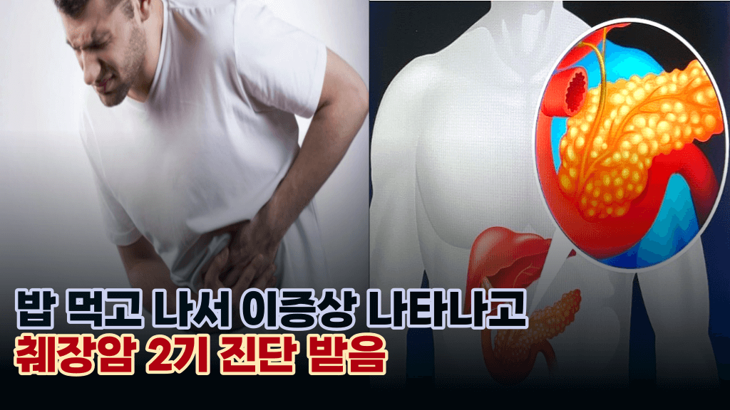 밥먹고 나서 ‘이 증상’ 나타나고 췌장암 2기 진단 받았습니다. 걱정되면 바로 병원 가세요.