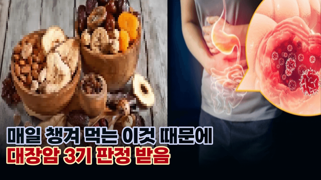 매일 즐겨 먹는 ‘이것’ 잘못 먹으면 암세포를 늘리는 최악의 독을 먹는 셈입니다