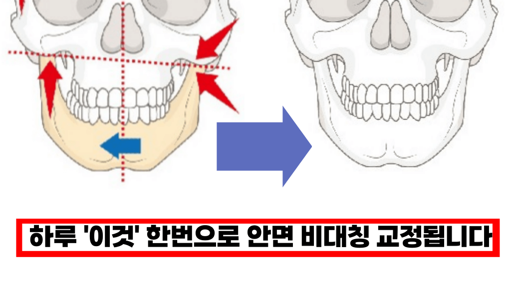 하루 한번만 해도 바로 효과 나타나는 기적의 안면비대칭 교정법